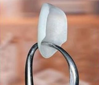 Photo of the tip of dental forceps holding a single porcelain veneer, for information on beautiful smile makeovers created by William Becker DDS in Hoffman Estates.