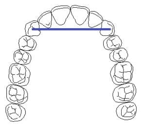 bridge engineering diagram